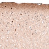 Monoclonal Anti-RELN antibody produced in mouse Prestige Antibodies&#174; Powered by Atlas Antibodies, clone CL5324, purified immunoglobulin, buffered aqueous glycerol solution