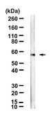 Anti-TRIM8 Antibody, clone 1I18 ZooMAb&#174; Rabbit Monoclonal recombinant, expressed in HEK 293 cells