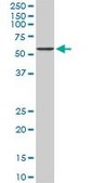 Monoclonal Anti-CACNB2 antibody produced in mouse clone 6C1, purified immunoglobulin, buffered aqueous solution