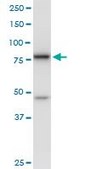 Anti-DDX18 antibody produced in mouse purified immunoglobulin, buffered aqueous solution