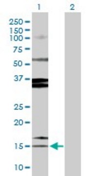 Anti-SPINK1 antibody produced in rabbit purified immunoglobulin, buffered aqueous solution