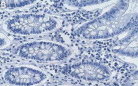 Anti-VHL Antibody, clone 1C10 ZooMAb&#174; Rabbit Monoclonal recombinant, expressed in HEK 293 cells