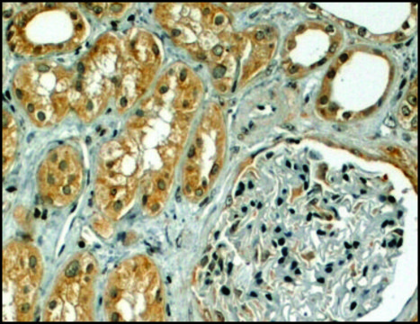 Anti-TRIM5 antibody produced in goat affinity isolated antibody, buffered aqueous solution