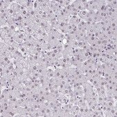 Anti-CBFA2T2 antibody produced in rabbit Prestige Antibodies&#174; Powered by Atlas Antibodies, affinity isolated antibody, buffered aqueous glycerol solution