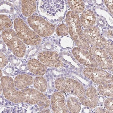 Anti-CTU1 antibody produced in rabbit Prestige Antibodies&#174; Powered by Atlas Antibodies, affinity isolated antibody, buffered aqueous glycerol solution
