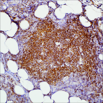HGAL (MRQ-49) Mouse Monoclonal Antibody