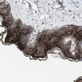 Anti-ALOX12 antibody produced in rabbit Prestige Antibodies&#174; Powered by Atlas Antibodies, affinity isolated antibody, buffered aqueous glycerol solution