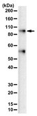 Anti-PI4-Kinase &#946;