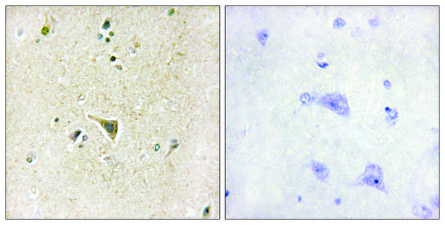 Anti-LRRK1 antibody produced in rabbit affinity isolated antibody