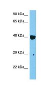 Anti-RARB antibody produced in rabbit affinity isolated antibody