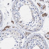 Anti-ALDOC antibody produced in rabbit Prestige Antibodies&#174; Powered by Atlas Antibodies, affinity isolated antibody, buffered aqueous glycerol solution