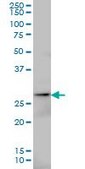 Monoclonal Anti-AK3 antibody produced in mouse clone 1D2, purified immunoglobulin, buffered aqueous solution