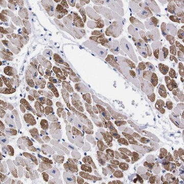 Anti-NEBL antibody produced in rabbit Prestige Antibodies&#174; Powered by Atlas Antibodies, affinity isolated antibody, buffered aqueous glycerol solution