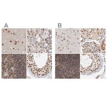 Anti-ZNF830 antibody produced in rabbit Prestige Antibodies&#174; Powered by Atlas Antibodies, affinity isolated antibody, buffered aqueous glycerol solution, Ab2