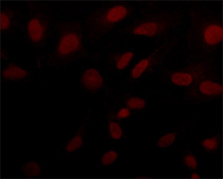 Anti-Sirt6 (N-terminal) antibody produced in rabbit ~1&#160;mg/mL, affinity isolated antibody, buffered aqueous solution