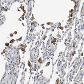 Anti-SLC25A20 antibody produced in rabbit Prestige Antibodies&#174; Powered by Atlas Antibodies, affinity isolated antibody, buffered aqueous glycerol solution