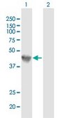 Anti-GLA antibody produced in mouse purified immunoglobulin, buffered aqueous solution