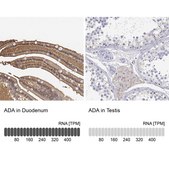 Anti-ADA antibody produced in rabbit Prestige Antibodies&#174; Powered by Atlas Antibodies, affinity isolated antibody, buffered aqueous glycerol solution