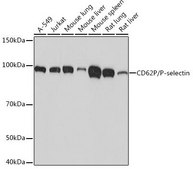 Anti-CD62P/P-selectin antibody produced in rabbit