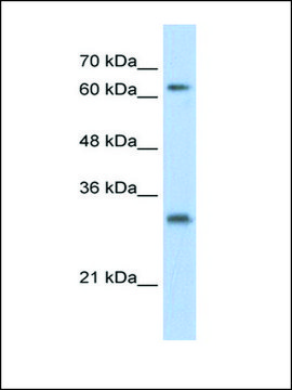 Anti-USP39 antibody produced in rabbit affinity isolated antibody