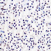 Anti-Phospho-Smad2-S465/467 + Smad3-S423/425 antibody produced in rabbit