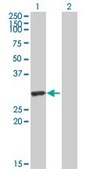 Anti-HYAL1 antibody produced in mouse purified immunoglobulin, buffered aqueous solution