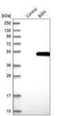 Anti-BGN antibody produced in rabbit Prestige Antibodies&#174; Powered by Atlas Antibodies, affinity isolated antibody, buffered aqueous glycerol solution