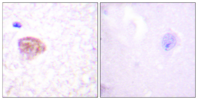 Anti-DDX3 antibody produced in rabbit affinity isolated antibody