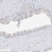 Anti-DCDC2 antibody produced in rabbit Prestige Antibodies&#174; Powered by Atlas Antibodies, affinity isolated antibody, buffered aqueous glycerol solution