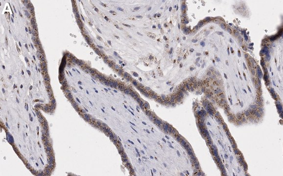 Anti-IGF-2R/CD222 Antibody, clone 2O9 ZooMAb&#174; Rabbit Monoclonal recombinant, expressed in HEK 293 cells