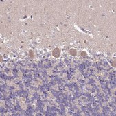 Anti-SETX antibody produced in rabbit Prestige Antibodies&#174; Powered by Atlas Antibodies, affinity isolated antibody, buffered aqueous glycerol solution