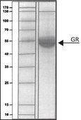 Glutathione Reductase human buffered aqueous solution, &#8805;10&#160;units/mg protein, recombinant, expressed in E. coli
