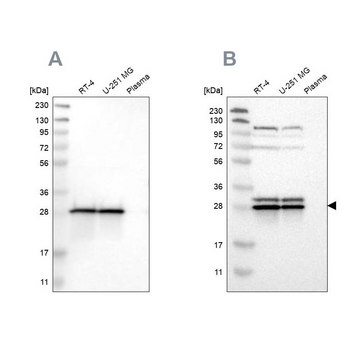 Anti-ETFB antibody produced in rabbit Prestige Antibodies&#174; Powered by Atlas Antibodies, affinity isolated antibody, buffered aqueous glycerol solution, Ab1