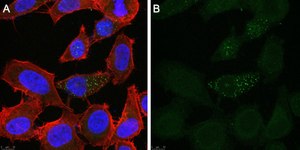 Anti-Tie-2 Antibody, clone 1C5 ZooMAb&#174; Rabbit Monoclonal recombinant, expressed in HEK 293 cells