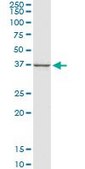 Monoclonal Anti-CTGF antibody produced in mouse clone 2C11, purified immunoglobulin, buffered aqueous solution