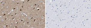 Anti-CaM Kinase II&#945; Antibody, clone 1C20 ZooMAb&#174; Rabbit Monoclonal recombinant, expressed in HEK 293 cells