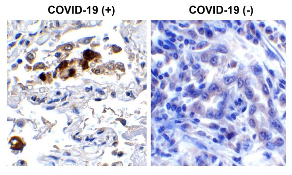 Anti-SARS-CoV-2 (COVID-19) Spike RBD antibody produced in rabbit affinity isolated antibody