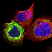 Anti-SCD antibody produced in rabbit Prestige Antibodies&#174; Powered by Atlas Antibodies, affinity isolated antibody, buffered aqueous glycerol solution