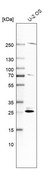 Anti-SPC25 antibody produced in rabbit Prestige Antibodies&#174; Powered by Atlas Antibodies, affinity isolated antibody, buffered aqueous glycerol solution