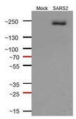 Anti-SARS-CoV-1/2 S Protein Antibody, clone 2B3E5 ZooMAb&#174; Mouse Monoclonal recombinant, expressed in HEK 293 cells