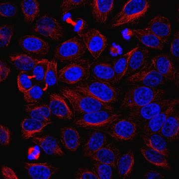 Anti-alpha-Tubulin Antibody, clone YOL1/34 clone YOL1/34, from rat