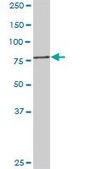 Anti-PFKM antibody produced in rabbit purified immunoglobulin, buffered aqueous solution