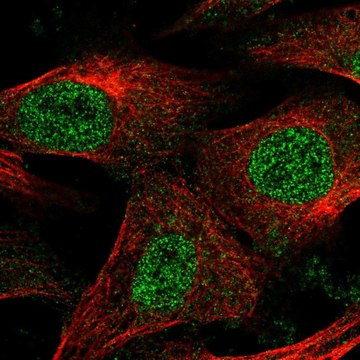 Anti-EPM2A antibody produced in rabbit Prestige Antibodies&#174; Powered by Atlas Antibodies, affinity isolated antibody, buffered aqueous glycerol solution