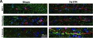 Monoclonal Anti-Neurofilament 200 (Phos. and Non-Phos.) antibody produced in mouse clone N52, ascites fluid
