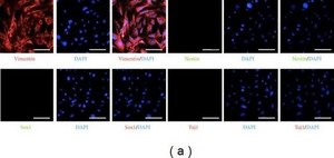 Anti-Nestin Antibody, clone 10C2 clone 10C2, Chemicon&#174;, from mouse