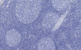 Anti-PCNA Antibody, clone 3B22 ZooMAb&#174; Rabbit Monoclonal recombinant, expressed in HEK 293 cells