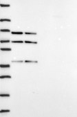 Anti-DDX5 antibody produced in rabbit Prestige Antibodies&#174; Powered by Atlas Antibodies, affinity isolated antibody, buffered aqueous glycerol solution