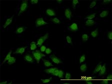 Monoclonal Anti-IRAK1 antibody produced in mouse clone 3F7, purified immunoglobulin, buffered aqueous solution