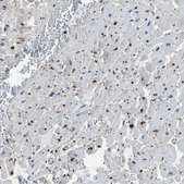 Anti-PDLIM1 antibody produced in rabbit Prestige Antibodies&#174; Powered by Atlas Antibodies, affinity isolated antibody, buffered aqueous glycerol solution