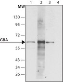 Anti-Glucocerebrosidase (C-terminal) antibody produced in rabbit ~1&#160;mg/mL, affinity isolated antibody, buffered aqueous solution